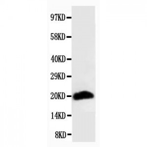 Myosin(Skeletal, Fast) Antibody (monoclonal)