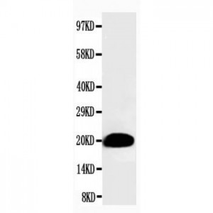 Myosin(Skeletal, Slow) Antibody (monoclonal)