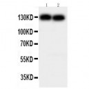 N Cadherin Antibody