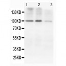 N-Cadherin Antibody (monoclonal)