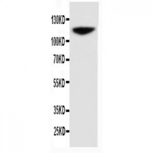 NCAM Antibody