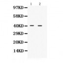 NDRG2  Antibody