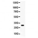 Neuropeptide Y  Antibody