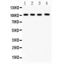 Neuropilin 1  Antibody