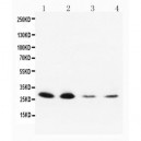 Neurotrophin 3 Antibody