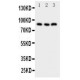 NFAT1 Antibody