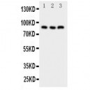 NFAT1 Antibody