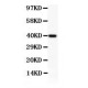 NFkB p100/p52  Antibody