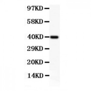 NFkB p100/p52  Antibody