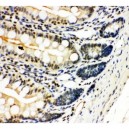 NFkB p100/p52 Antibody