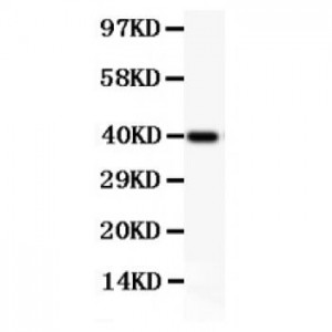 NFkB p105/P50  Antibody