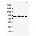 NF-kB p65 Antibody