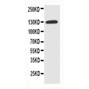 NKCC1 Antibody