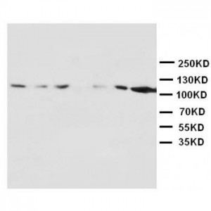 NMDAR1 Antibody