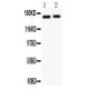 NMDAR2A Antibody