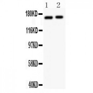 NMDAR2A Antibody