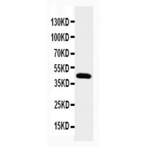 NPHS2 Antibody