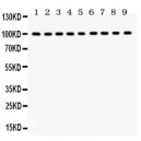 NR3C1  Antibody