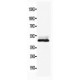 NSE Antibody