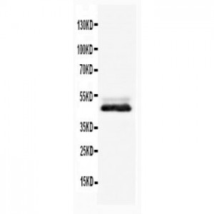 NSE Antibody