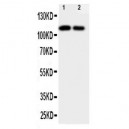 NTE Antibody