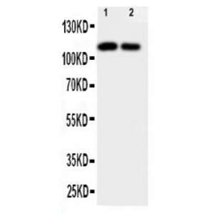 NTE Antibody