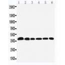 Nucleophosmin Antibody