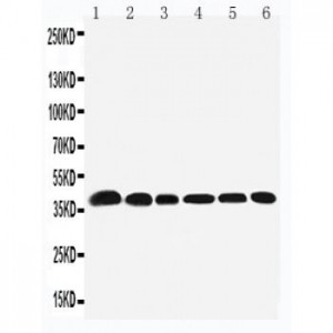 Nucleophosmin Antibody