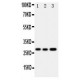 Oncostatin M Antibody