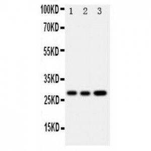 Oncostatin M Antibody