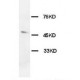 Orexin Receptor 1 Antibody