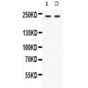 Otoferlin  Antibody