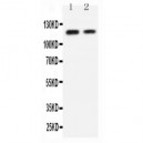 P cadherin Antibody