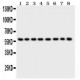 P2X2  Antibody