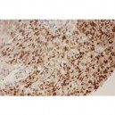 P53  Antibody