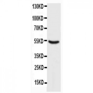 p53 Antibody (monoclonal)