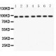 p95 NBS1  Antibody