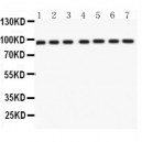 p95 NBS1  Antibody