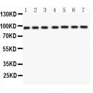 p95 NBS1  Antibody