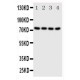 PAK6 Antibody