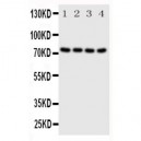 PAK6 Antibody