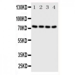 PAK6 Antibody