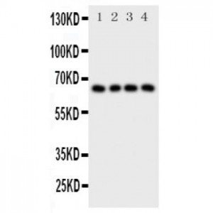 Parathyroid Hormone Receptor 1 Antibody