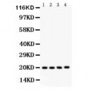 PARK7/DJ1  Antibody