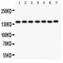 PARP  Antibody