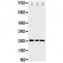 PBP Antibody