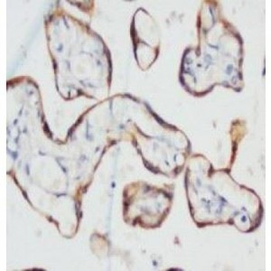 PCK Antibody (monoclonal)