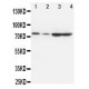 PCSK9 Antibody