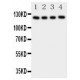 PDGF Receptor alpha Antibody