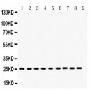 Peroxiredoxin 3  Antibody